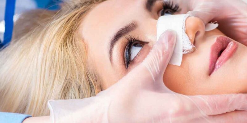 Rhinoplasty Dubai – Discover Expert Nose Reshaping