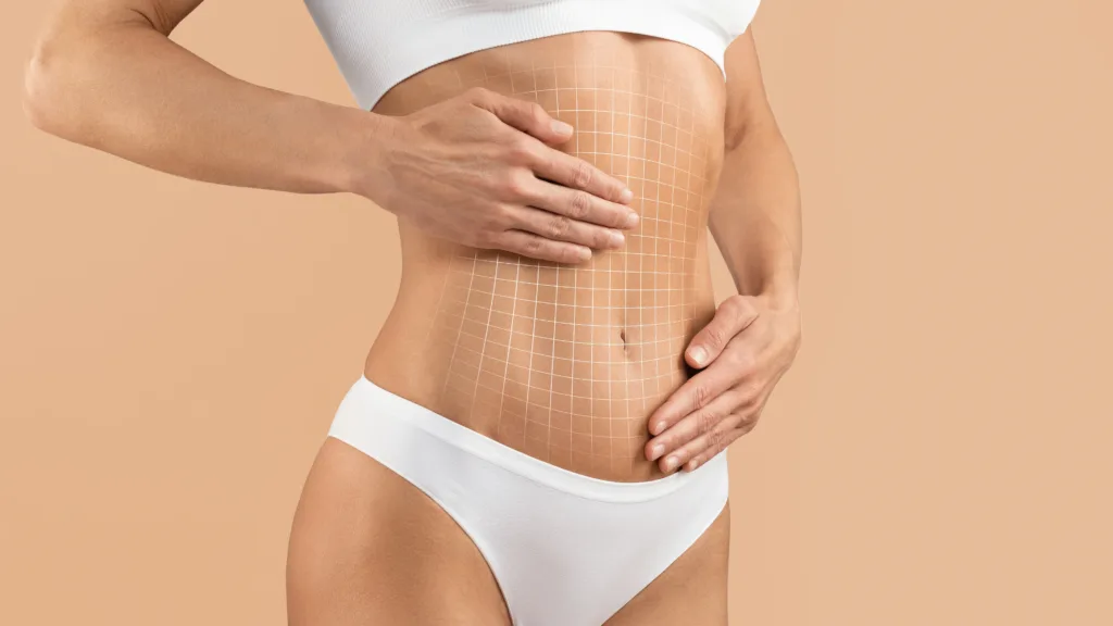 Body contouring results showcasing a toned abdomen and smooth skin after weight loss surgery.