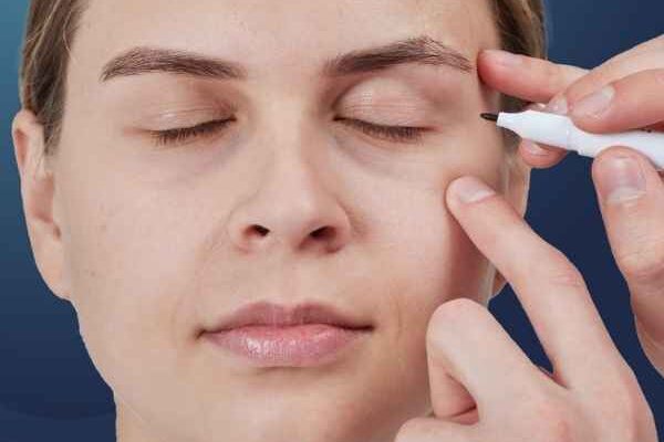 Eyelid Surgery Dubai