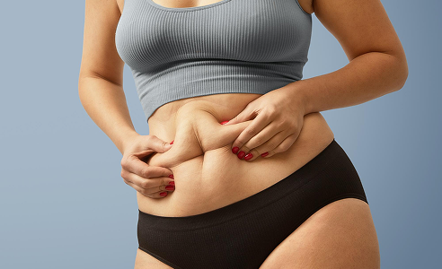 fat transfer in dubai