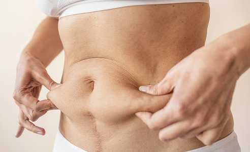 mommy makeover in dubai